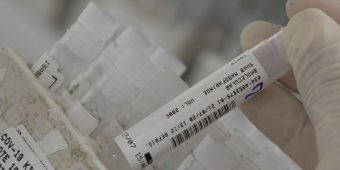 An employee at the Hermes Pardini laboratory shows a sample of the coronavirus disease (COVID-19) testing with PCR amplification, in Vespasiano, near Belo Horizonte, Brazil, July 23, 2020. Picture taken July 23, 2020. REUTERS/Washington Alves