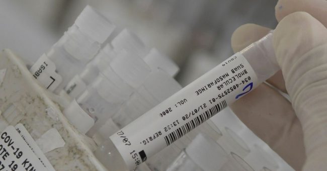 An employee at the Hermes Pardini laboratory shows a sample of the coronavirus disease (COVID-19) testing with PCR amplification, in Vespasiano, near Belo Horizonte, Brazil, July 23, 2020. Picture taken July 23, 2020. REUTERS/Washington Alves